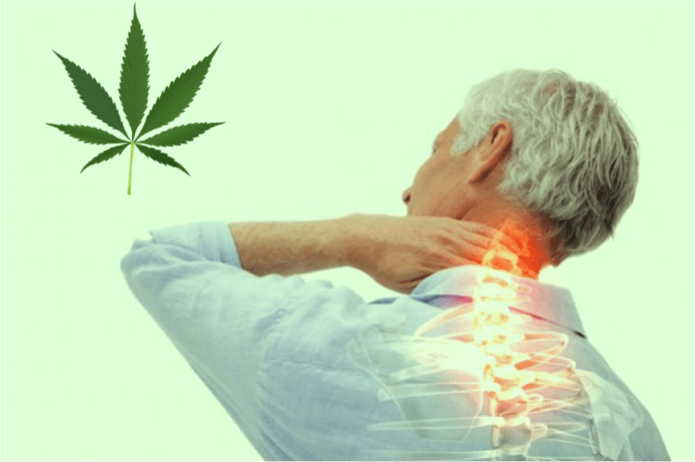 La Cannabis Sativa per la terapia del dolore